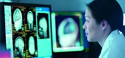 Home | InformMe - Stroke Foundation